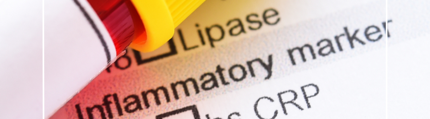 Znaczenie badaÅ CRP w codziennej diagnostyce â nasza oferta dla placÃ³wek medycznych