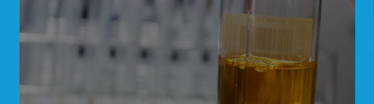 Analiza moczu w badaniach laboratoryjnych