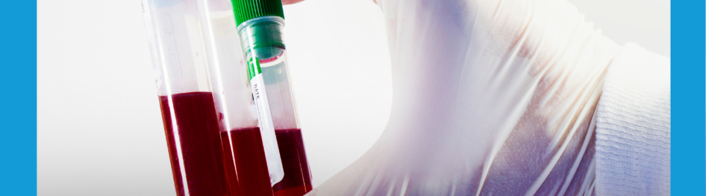 Wysoka jakoÅÄ i precyzja